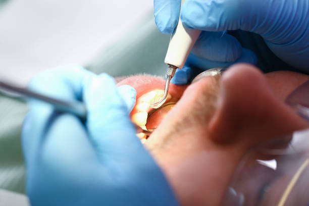 Best Broken or Cracked Tooth Emergency Dentist in Silver Summit, UT